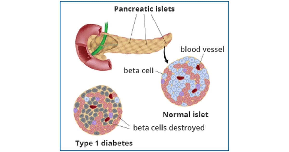 Ilustração educativa do pâncreas e de ilhotas pancreáticas; não é foto do experimento. Imagem: NIDDK, NIH.